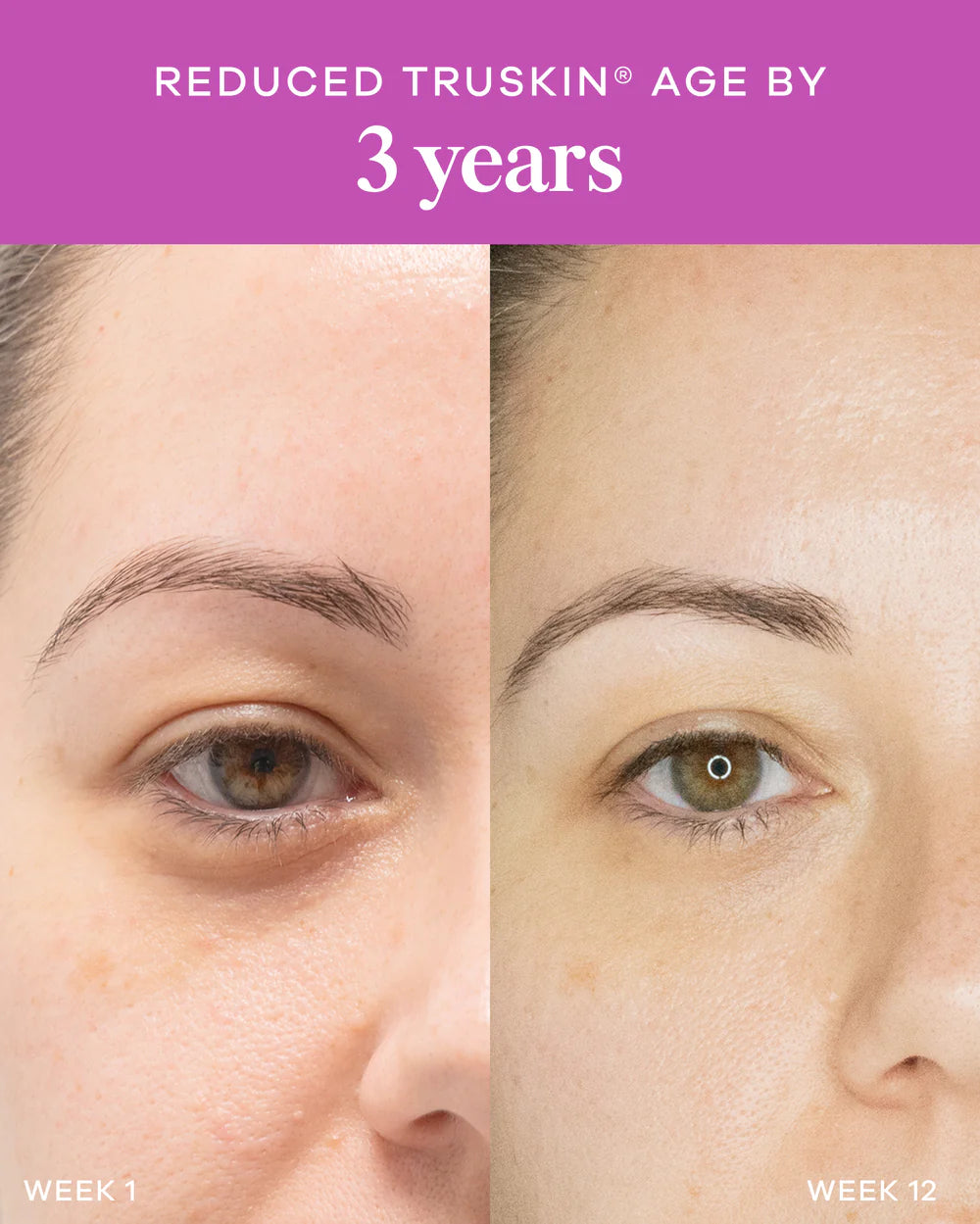 Vida Glow Liquid Collagen Skin Health Mixed Berry - 15 sachets