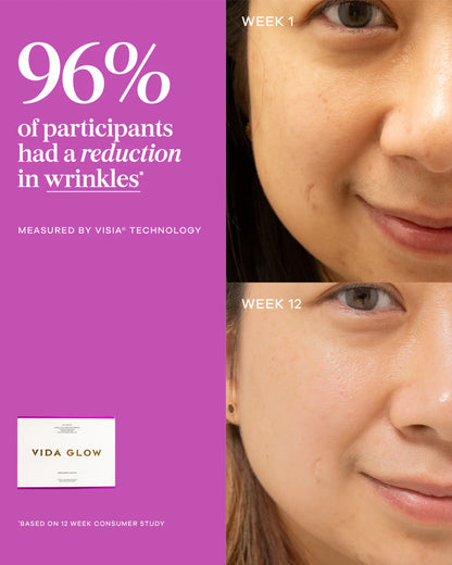 Vida Glow Liquid Collagen Skin Health Mixed Berry - 15 sachets