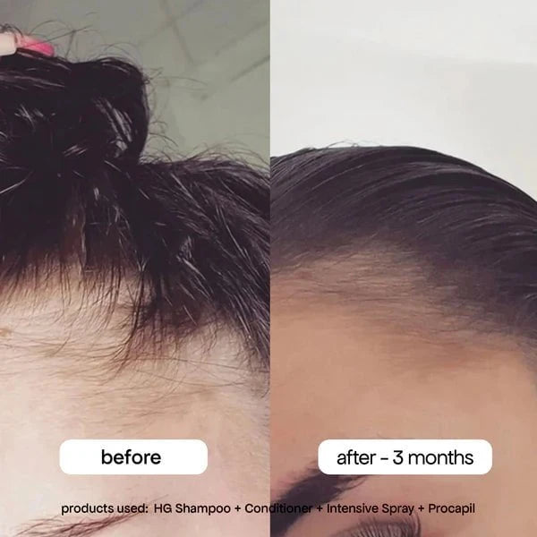 BondiBoost HG Procapil Hair Tonic 125ml