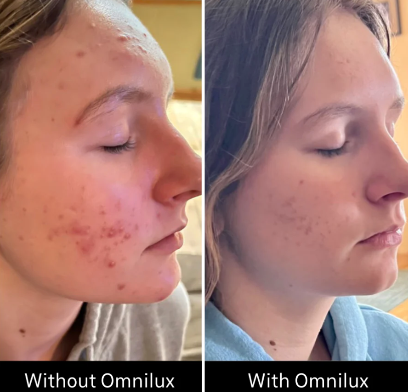 Omnilux Omnilux Clear LED Light Therapy