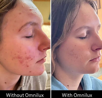 Omnilux Omnilux Clear LED Light Therapy