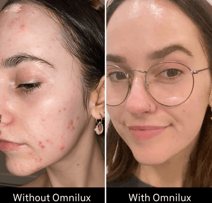 Omnilux Omnilux Clear LED Light Therapy