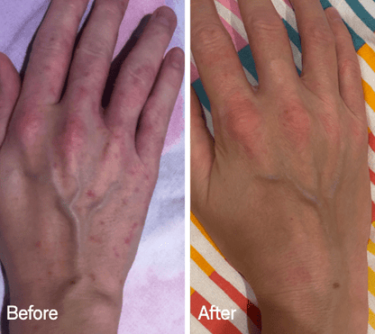Omnilux Omnilux Contour Glove LED Light Therapy