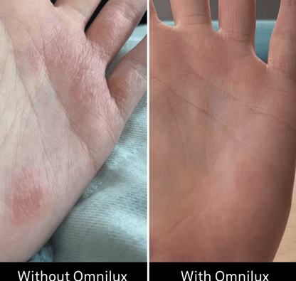 Omnilux Omnilux Contour Glove LED Light Therapy