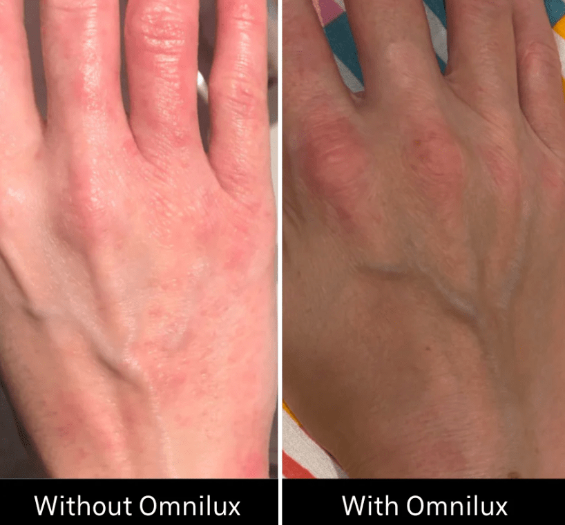 Omnilux Omnilux Contour Glove LED Light Therapy