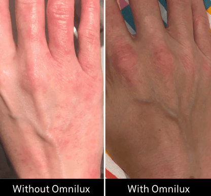 Omnilux Omnilux Contour Glove LED Light Therapy
