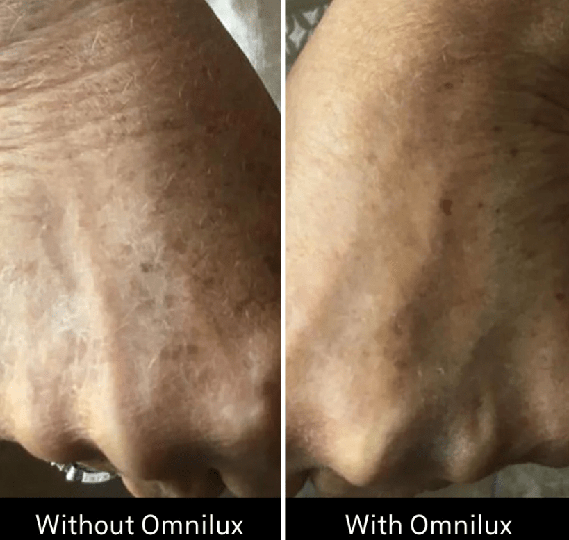 Omnilux Omnilux Contour Glove LED Light Therapy