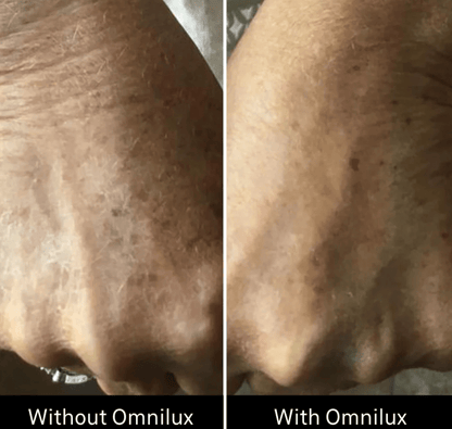 Omnilux Omnilux Contour Glove LED Light Therapy