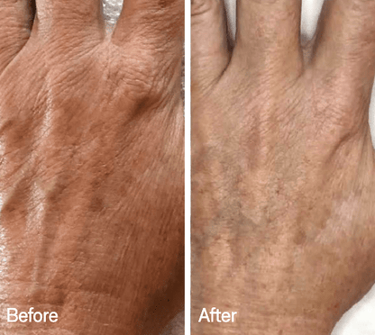 Omnilux Omnilux Contour Glove LED Light Therapy
