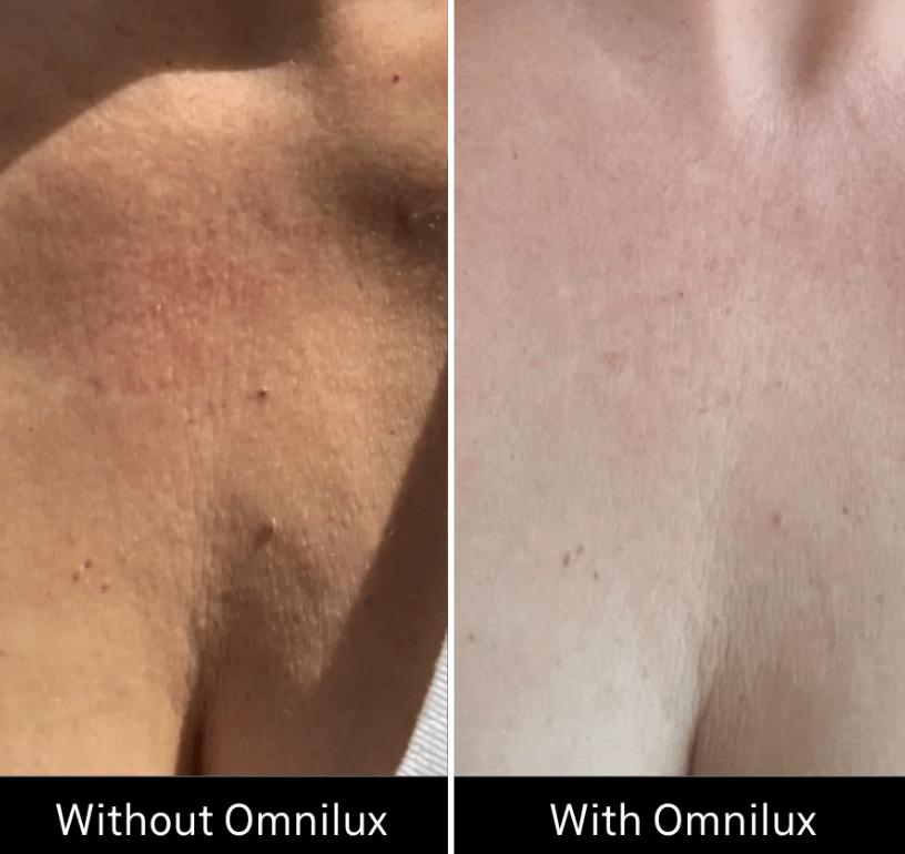 Omnilux Omnilux Contour Neck & Décolleté LED Light Therapy