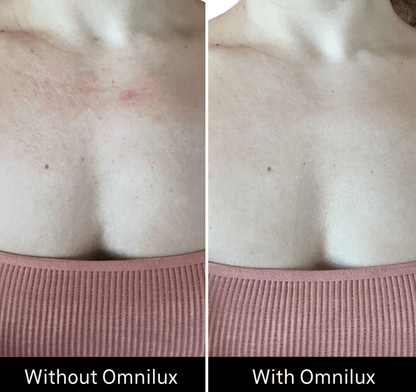 Omnilux Omnilux Contour Neck & Décolleté LED Light Therapy