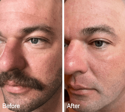 Omnilux Omnilux Men LED Light Therapy