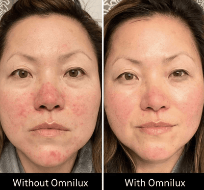 Omnilux Omnilux Contour Face