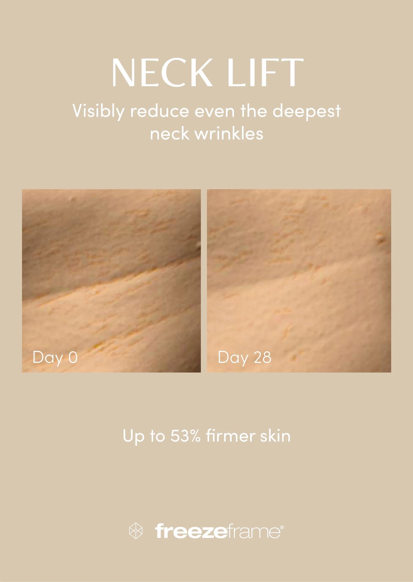 freezeframe Neck Lift 50ml