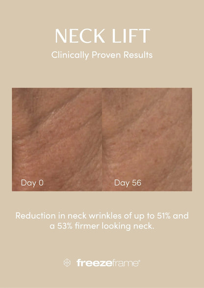 freezeframe Neck Lift 50ml