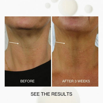 The Jojoba Company The Jojoba Company Neck & Decolletage Lifting Concentrate 30ml Skin Care