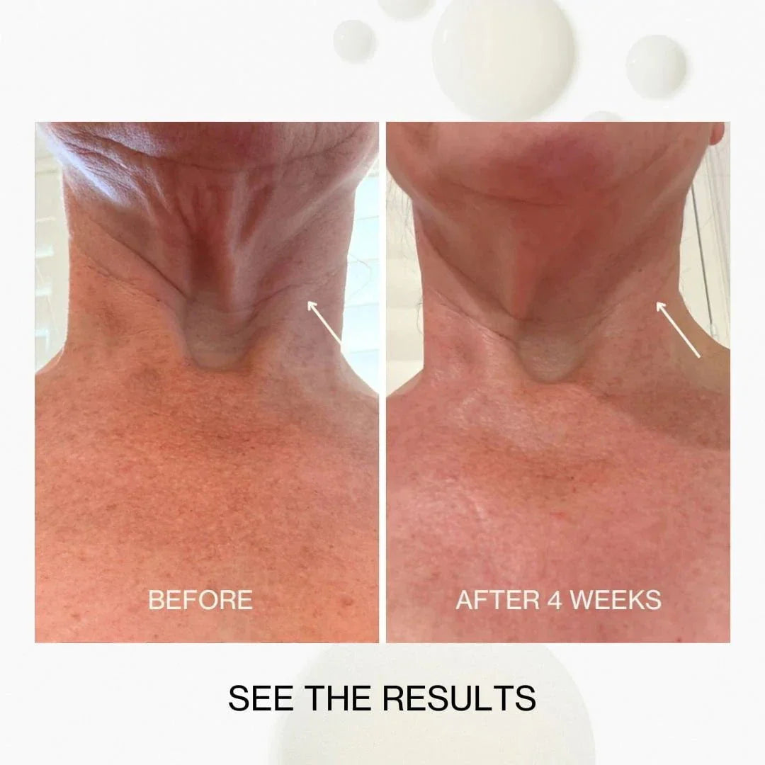 The Jojoba Company The Jojoba Company Neck & Decolletage Lifting Concentrate 30ml Skin Care